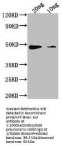 aur Antibody