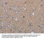PDE4D Antibody
