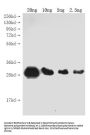 Genome polyprotein Antibody