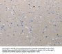CMTM1 Antibody