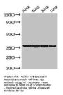 dps Antibody