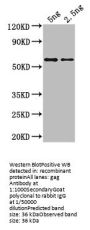 gag Antibody