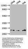 Major mite allergen Der p 23 Antibody