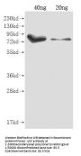 iutA Antibody