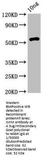 rsrIM Antibody