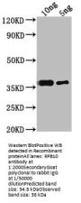 RPB10 Antibody