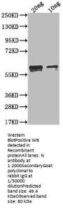 N Antibody