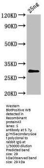 S Antibody