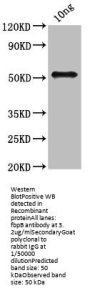 fbpB Antibody