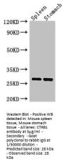 CTRB1 Antibody