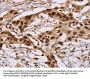 NUP50 Antibody