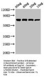 NP Antibody