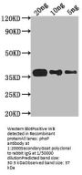 phoP Antibody