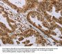CFLAR Antibody