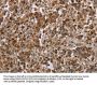 CFLAR Antibody
