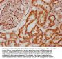 GLDC Antibody