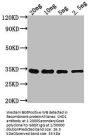 CHD1 Antibody