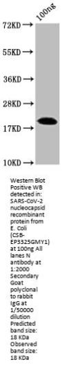 N Antibody