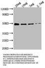 DXR Antibody