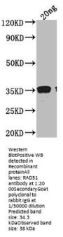 RAD51 Antibody