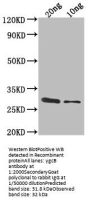 ygcB Antibody
