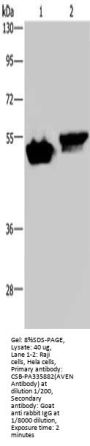 AVEN Antibody