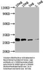 prgI Antibody