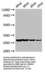 PHLPII Antibody