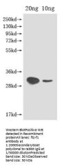 ftz-f1 Antibody