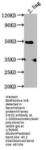 SWD2 Antibody