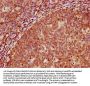 TNR Antibody