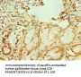 GATA2 Antibody