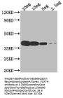 VCATH Antibody