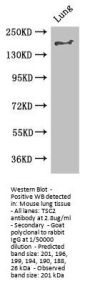 TSC2 Antibody
