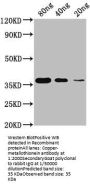 Copper-metallothionein Antibody