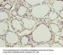 CMC4 Antibody