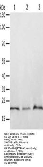 PTP4A2 Antibody