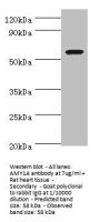 AMY1A Antibody