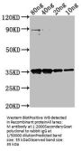 M Antibody