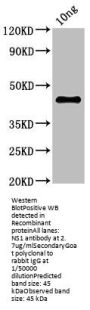 NS1 Antibody
