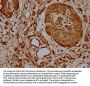 HSPA1A Antibody