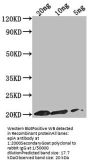epiA Antibody