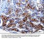 FTH1 Antibody