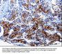 FTH1 Antibody