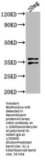 ARCA Antibody
