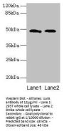 surA Antibody