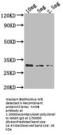 AADB Antibody