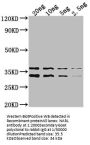 NARL Antibody