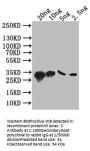 S Antibody