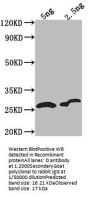 D Antibody